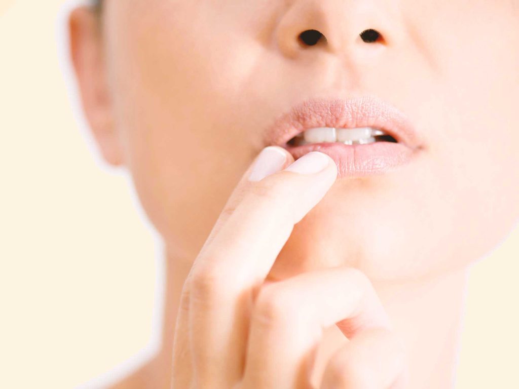 چند روش برای از بین بردن آفت دهان