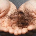 علت ریزش مو از ریشه چیست
