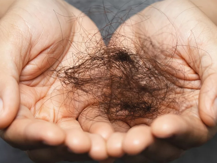 علت ریزش مو از ریشه چیست