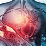 چربی خون عصبی