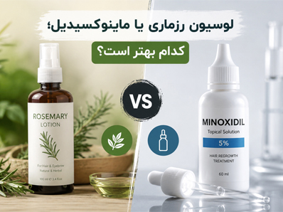 لوسیون رزماری یا ماینوکسیدیل
